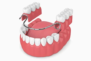 What Are the Newest Types of Dentures