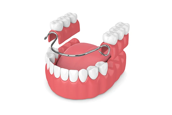Why Choose Macomb Dental Group for Denture Stabilization