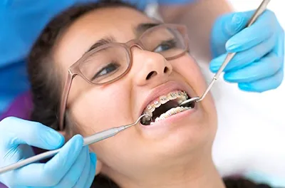 How to Reduce Gaps Between Teeth